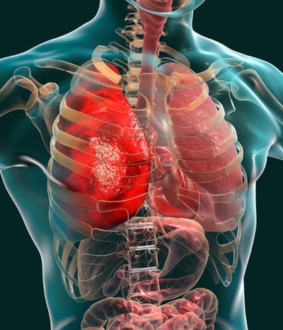 L'embolie pulmonaire : comprendre et prévenir cette urgence médicale