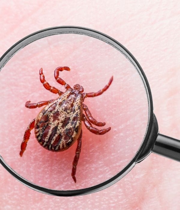 La maladie de Lyme : comprendre, reconnaître et traiter cette infection transmise par les tiques