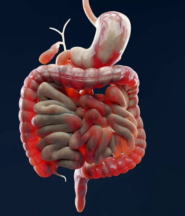 La maladie de Crohn : comprendre ses symptômes, traitements et impact sur la vie quotidienne